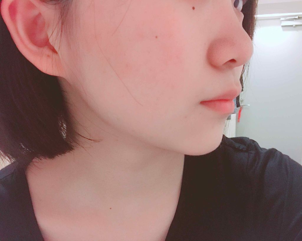 クラリファイング ローション 1/CLINIQUE/拭き取り化粧水を使ったクチコミ（2枚目）