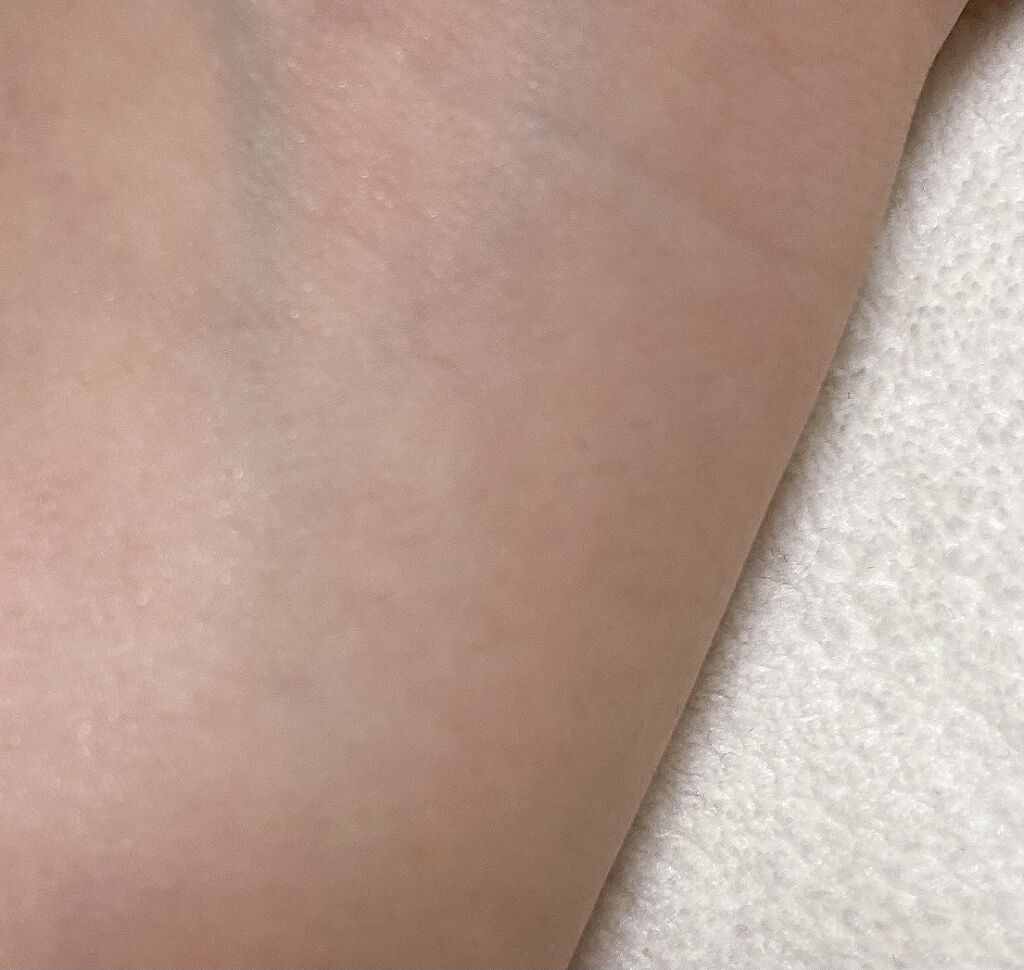 スーパー毛穴ピールセラム/ラボラボ/美容液を使ったクチコミ（3枚目）