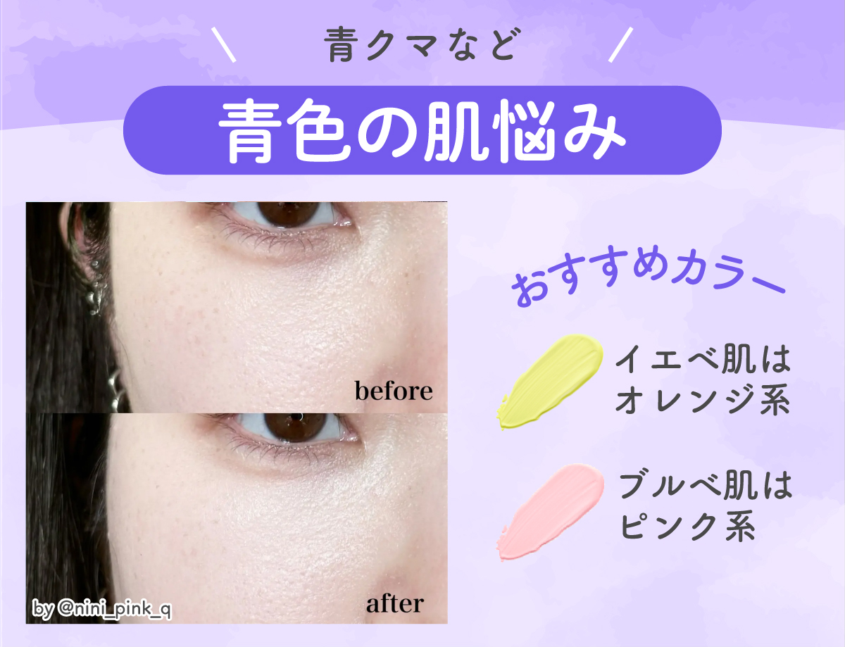 青クマなど青色の肌悩みがある場合はイエベ肌はオレンジ系、ブルべ肌はピンク系のカラーがおすすめです。