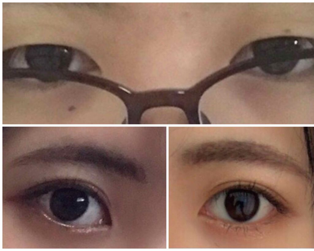 アイビューティー フィクサー WP/アストレア ヴィルゴ/二重まぶた用アイテムを使ったクチコミ(1枚目)