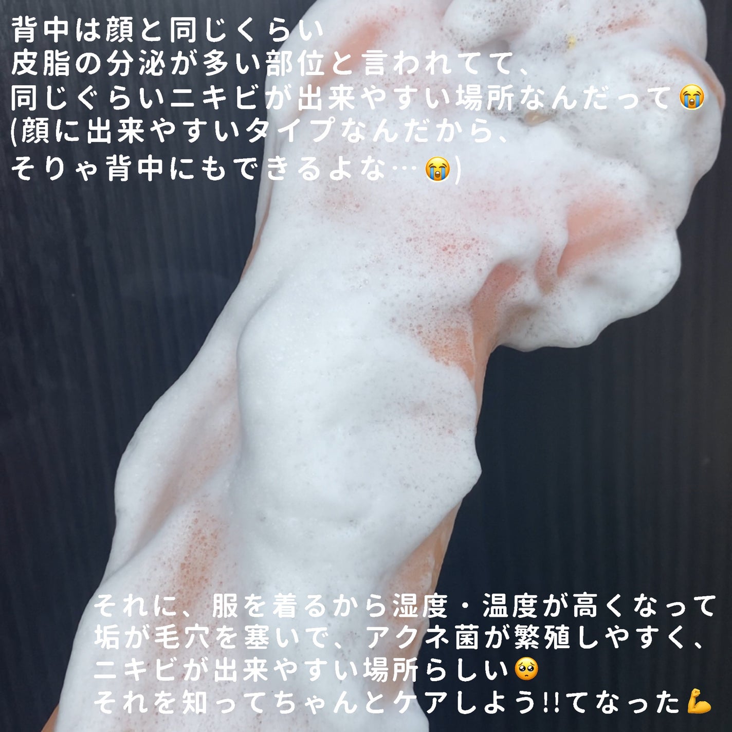 ニキビを防ぐ薬用石鹸 ForBack/ペリカン石鹸/ボディ石鹸を使ったクチコミ(4枚目)