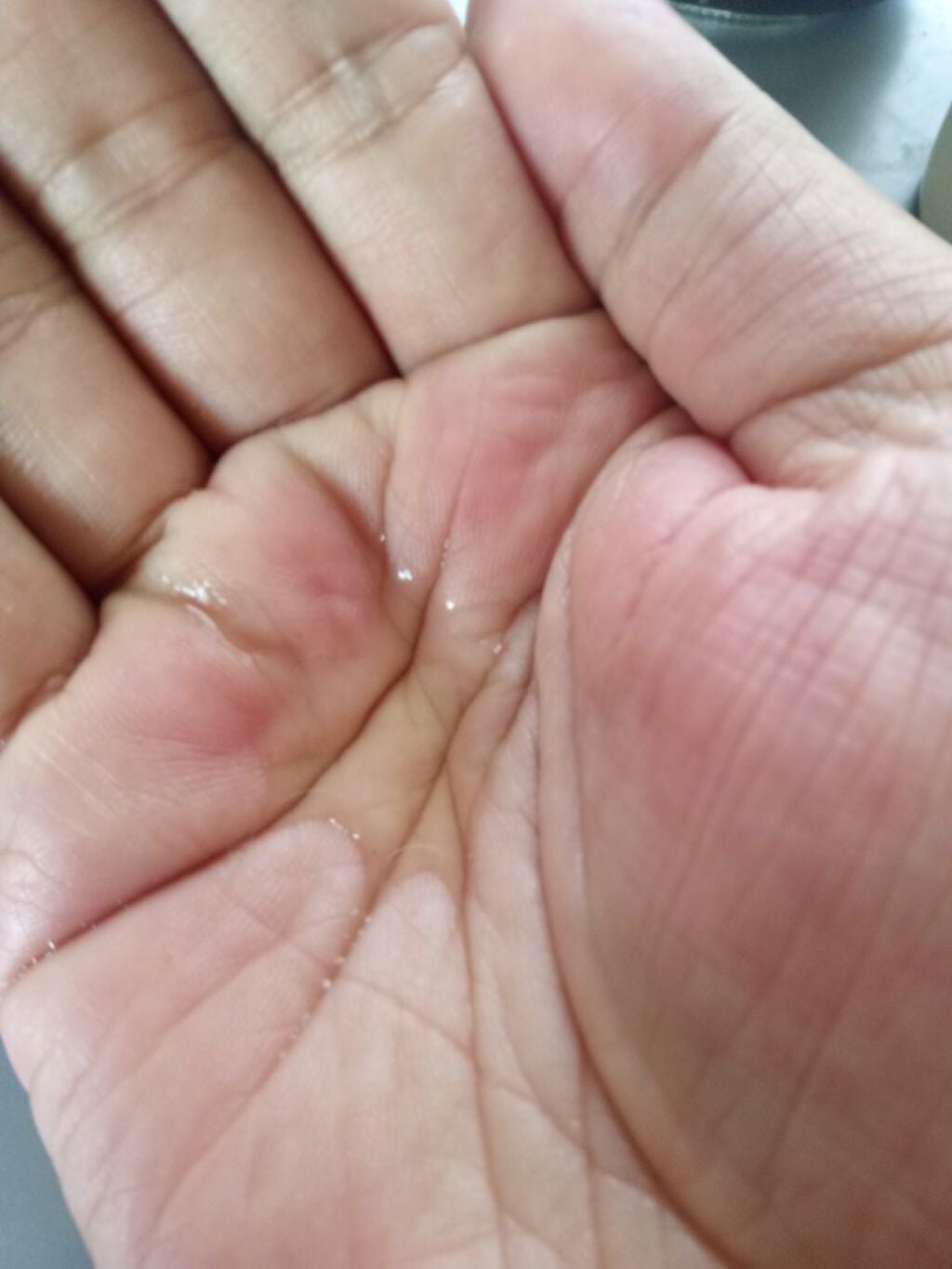 スキンフェイドローションV/デルミサ/化粧水を使ったクチコミ(3枚目)