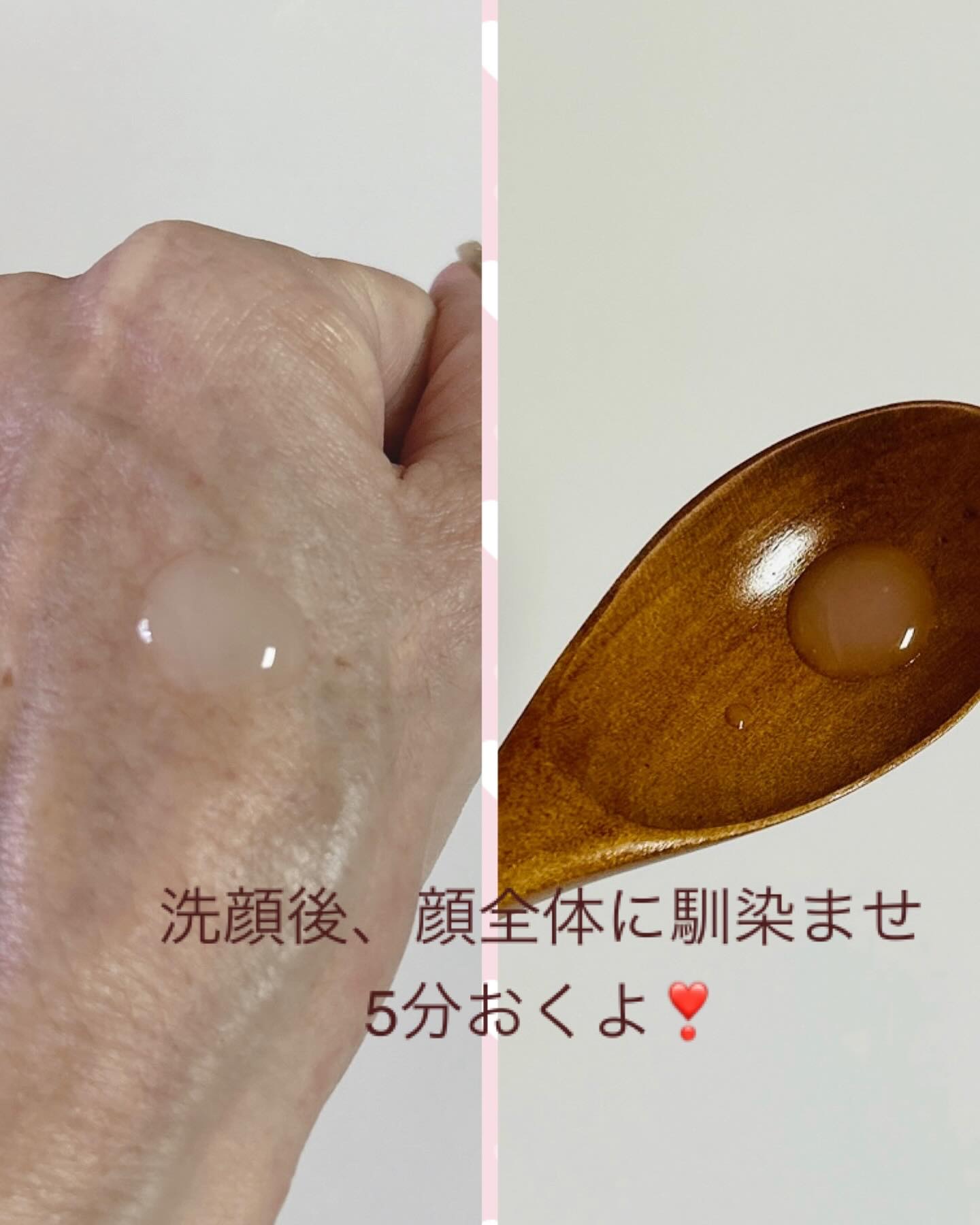 トランスダーマ  C/トランスダーマ/美容液を使ったクチコミ（3枚目）