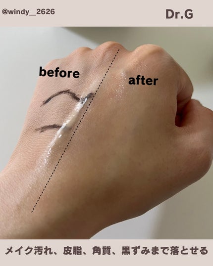 グリーンディープポアクレンジングバーム/Dr.G/クレンジングバームを使ったクチコミ(4枚目)