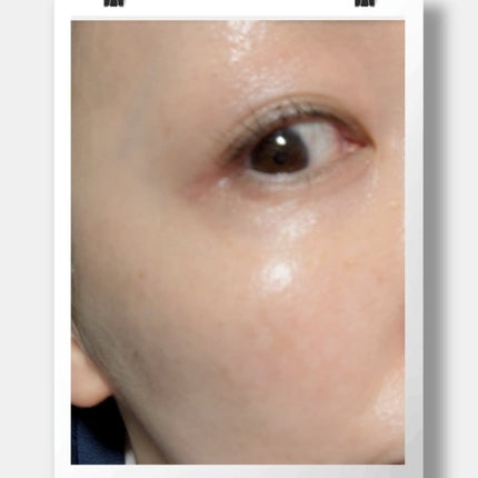 ドレススノー ローション【医薬部外品】 /アテニア/化粧水を使ったクチコミ(8枚目)