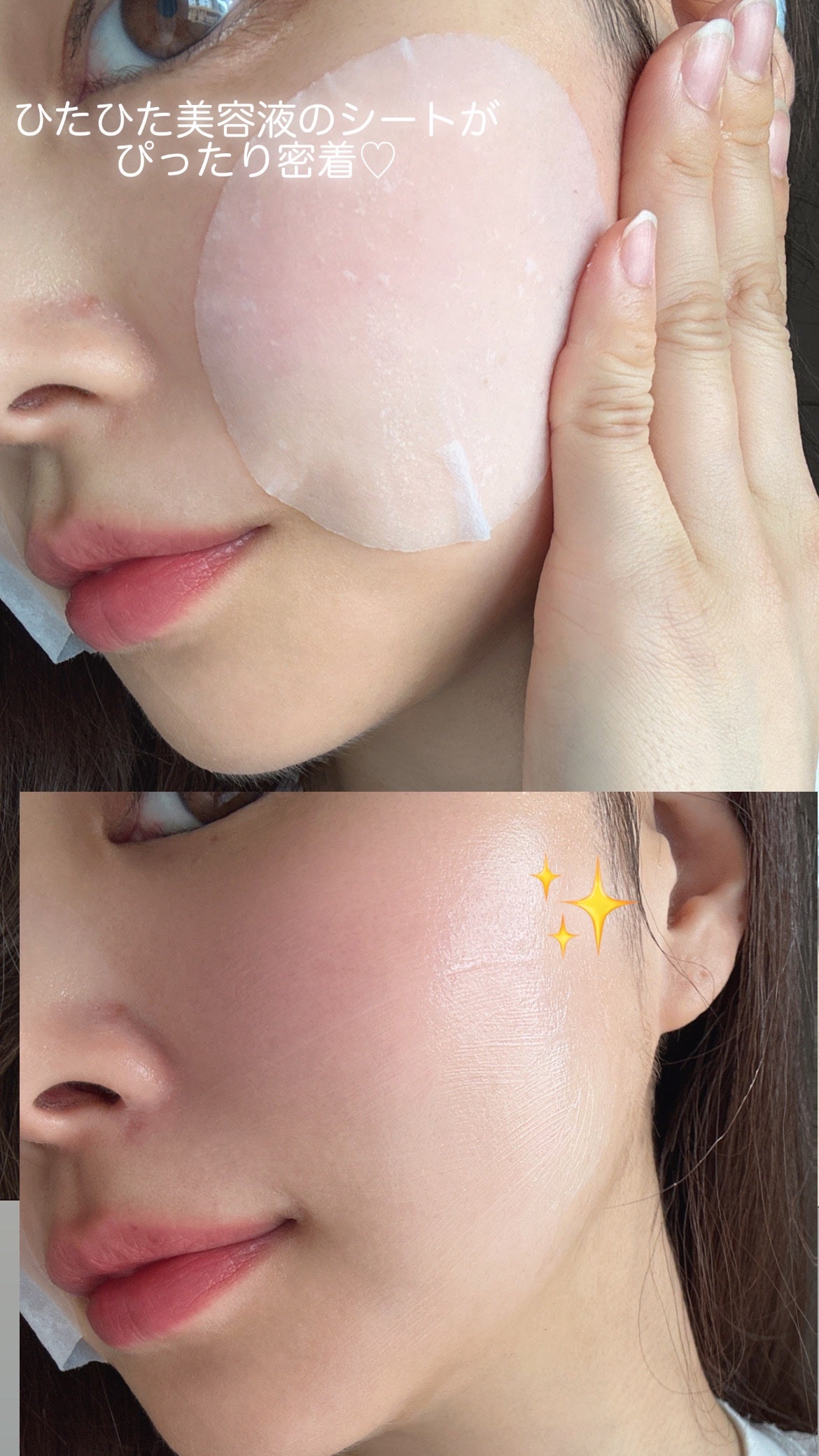 エイシカ365クイックマスクパッド/AESTURA/トナーパッドを使ったクチコミ(10枚目)