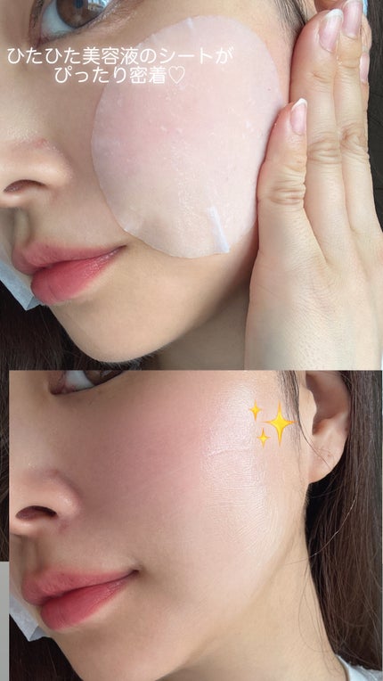 エイシカ365クイックマスクパッド/AESTURA/トナーパッドを使ったクチコミ(10枚目)