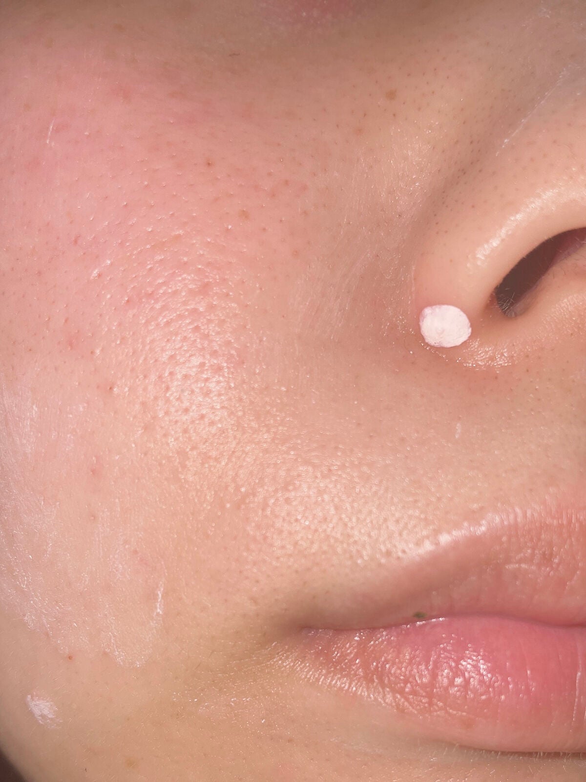 ピンクパウダースポットトリートメント/EUYIRA/その他スキンケアを使ったクチコミ(5枚目)