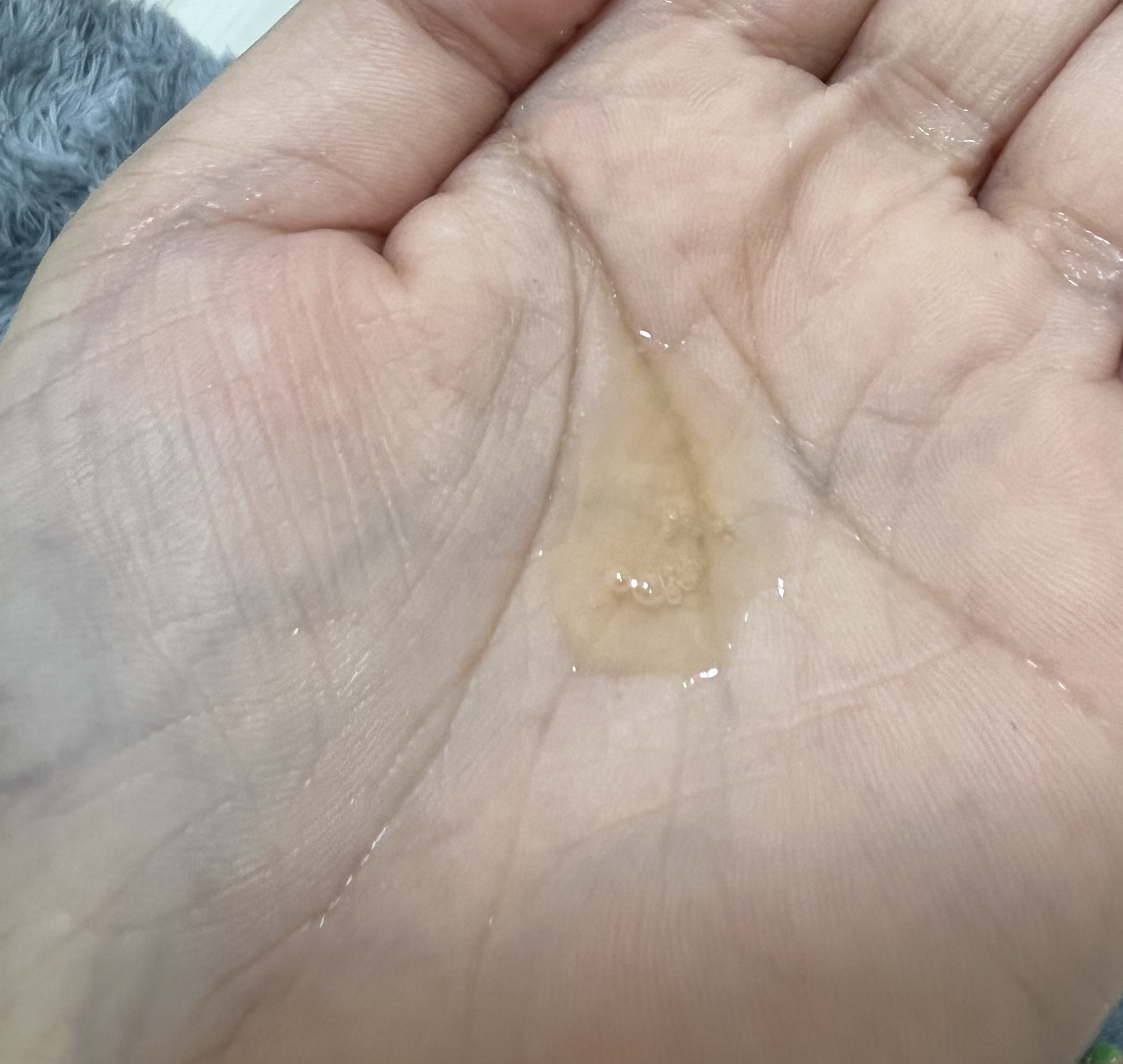 ドクダミ80％スージングアンプル/Anua/美容液を使ったクチコミ（2枚目）