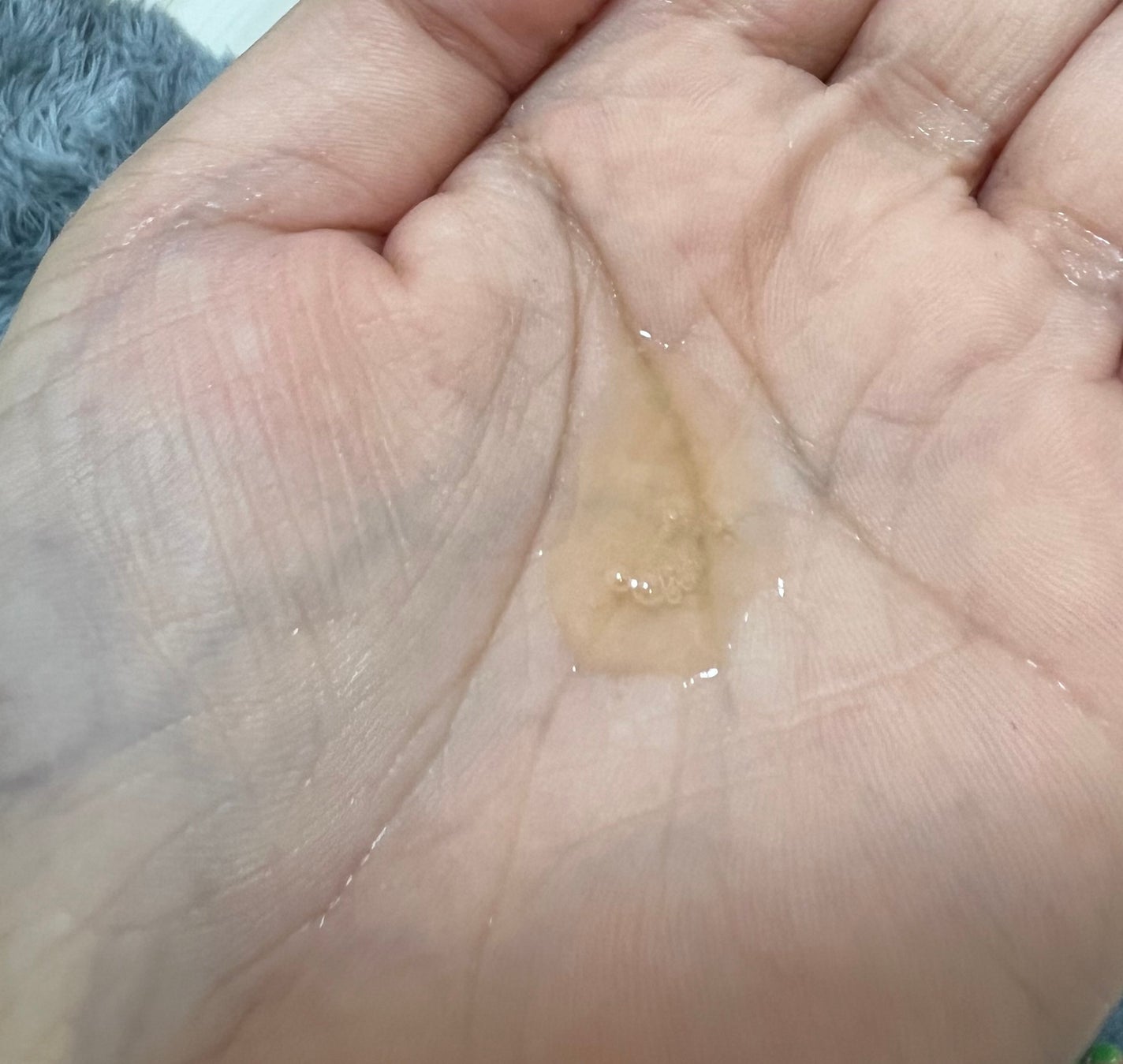 ドクダミ80%スージングアンプル/Anua/美容液を使ったクチコミ(2枚目)