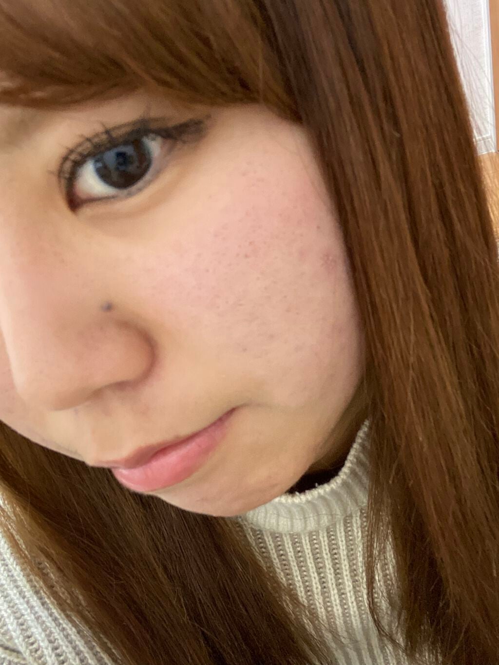 orange_blush_gxo on LIPS 「右の頬はまだ赤み全然あるけど、化粧して少しはマシになるぐらいま..」(2枚目)