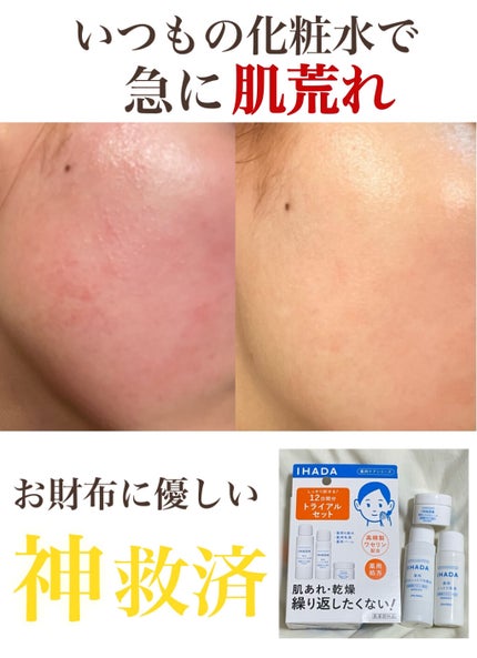 スキンケアセット(とてもしっとり)/IHADA/トライアルキットを使ったクチコミ(2枚目)