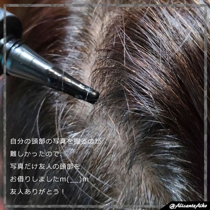 ナノグロウリッチ/iqumore/頭皮ローションを使ったクチコミ(3枚目)