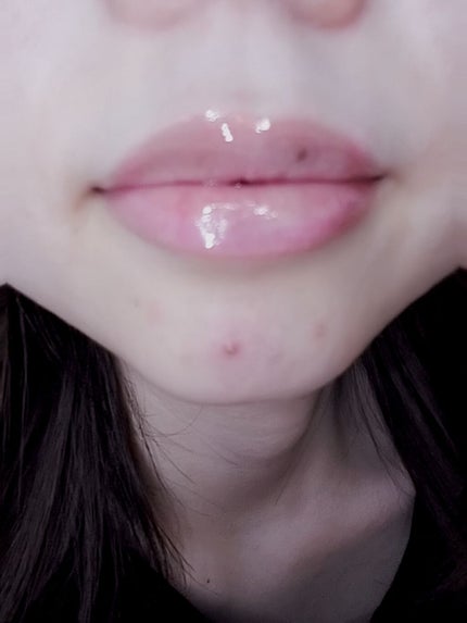 ハニーフルリップ もも色ボリューム/カントリー&ストリーム/リップ美容液を使ったクチコミ(1枚目)