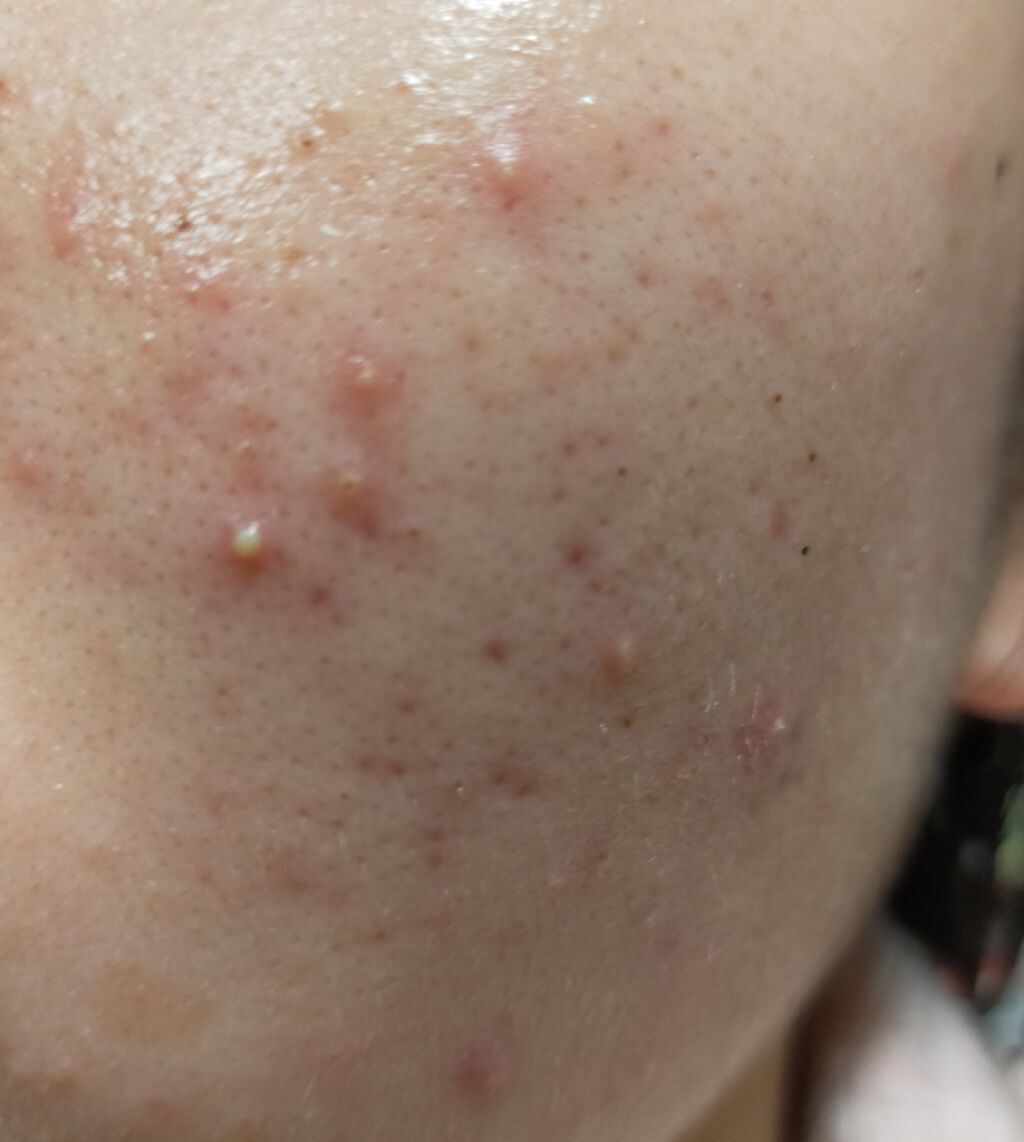 花 on LIPS 「はじめまして中学3年生女子です。写真汚くてごめんなさい🙇💦投稿..」(2枚目)