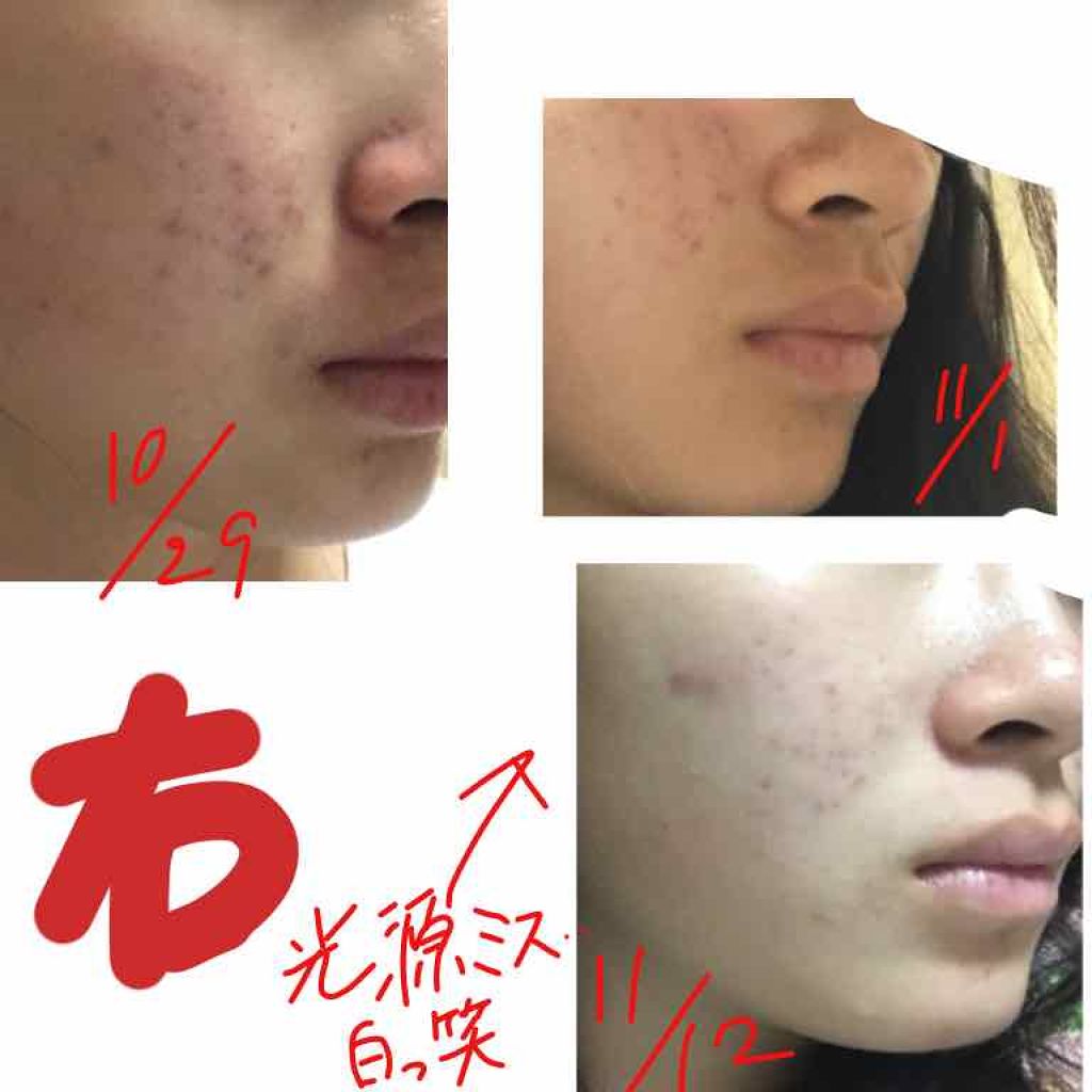 クリアケア乳液/無印良品/乳液を使ったクチコミ（3枚目）