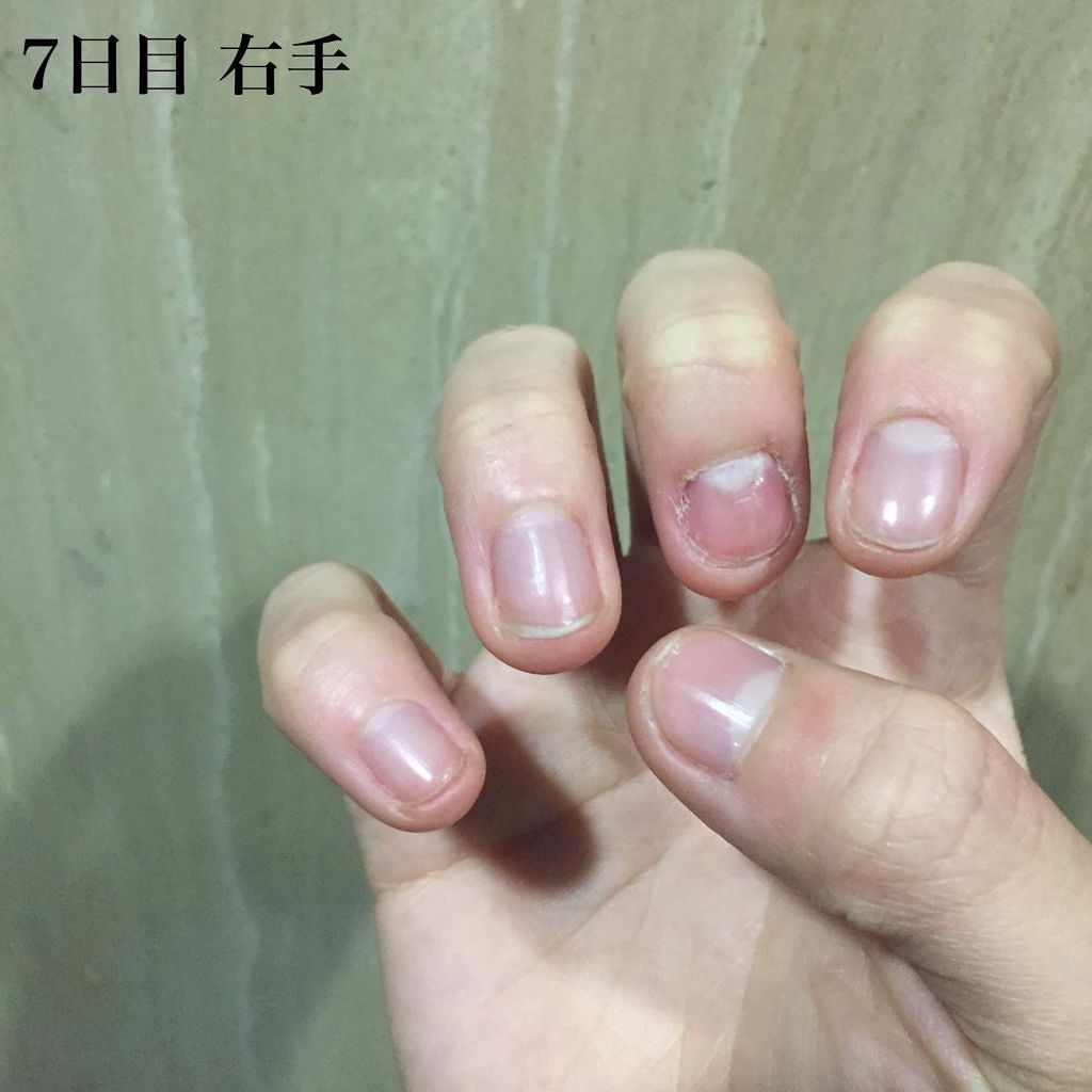 ピンクピンク on LIPS 「みなさんこんにちはこんばんは«爪を噛んでしまう癖をなくそう企画..」(2枚目)