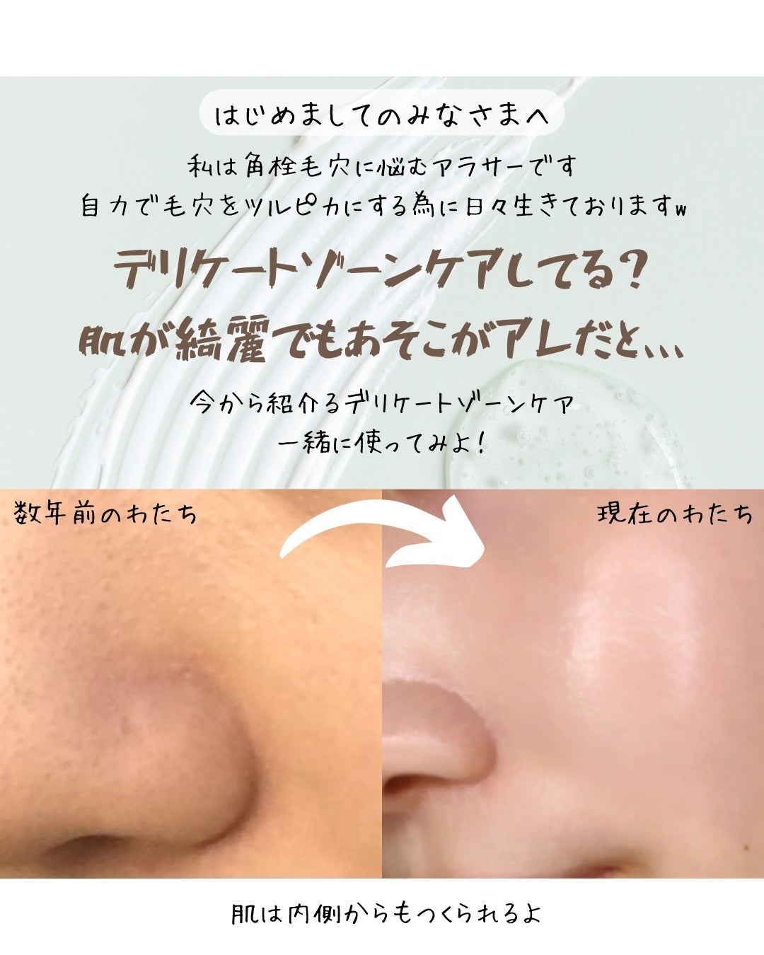 アンティーム フェミニン ウォッシュ/アンティーム オーガニック/デリケートゾーンケアを使ったクチコミ(2枚目)