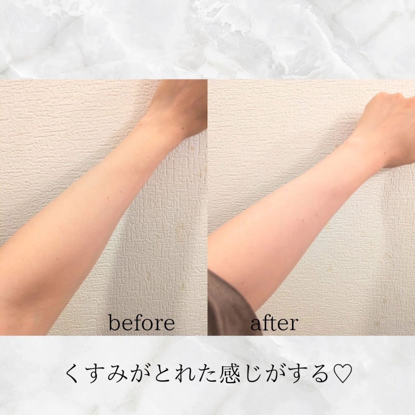 AHA·BHA·PHA 30デイズミラクルアクネボディクレンザー/SOME BY MI/ボディソープを使ったクチコミ(3枚目)