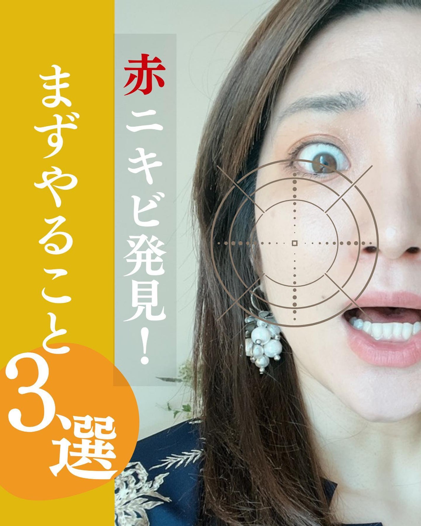 おゆみ|ニキビ・ニキビ跡ケア on LIPS 「@______ohyoume◀︎他の投稿はこちらから💄【ニキビ..」(1枚目)