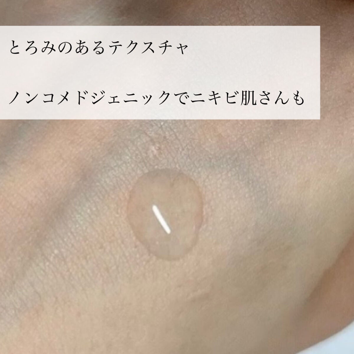 ドクダミカーミングタッチスポットパッド/Abib /トナーパッドを使ったクチコミ(7枚目)