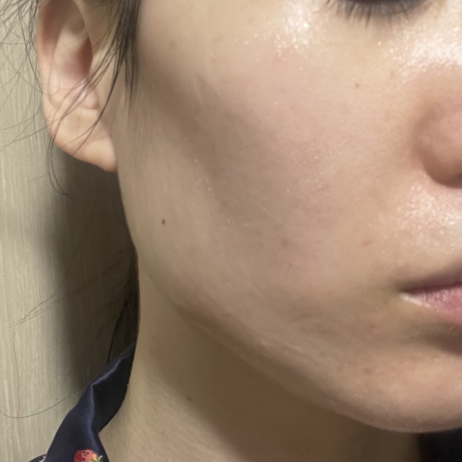 復活草クリーム ニュートリションチューブ/Abib /フェイスクリームを使ったクチコミ（3枚目）