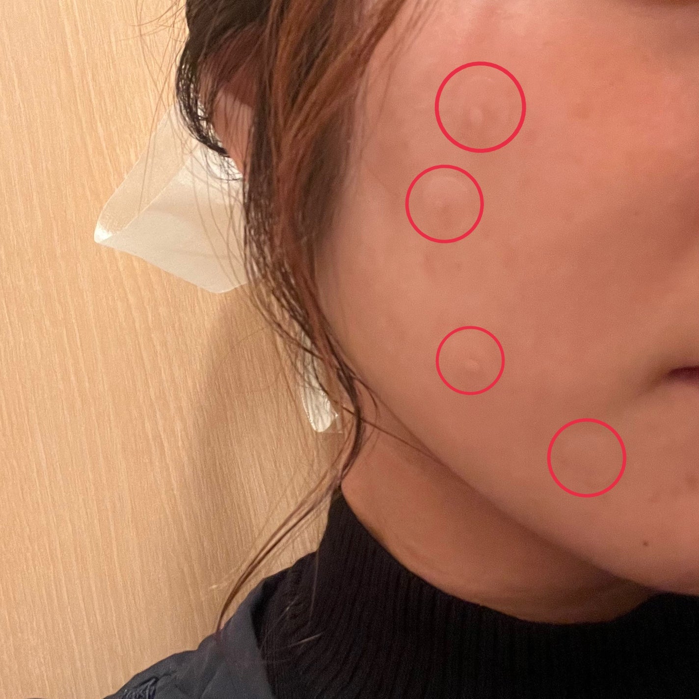 プロCICA クリアスポットパッチ/VT/その他スキンケアを使ったクチコミ(2枚目)