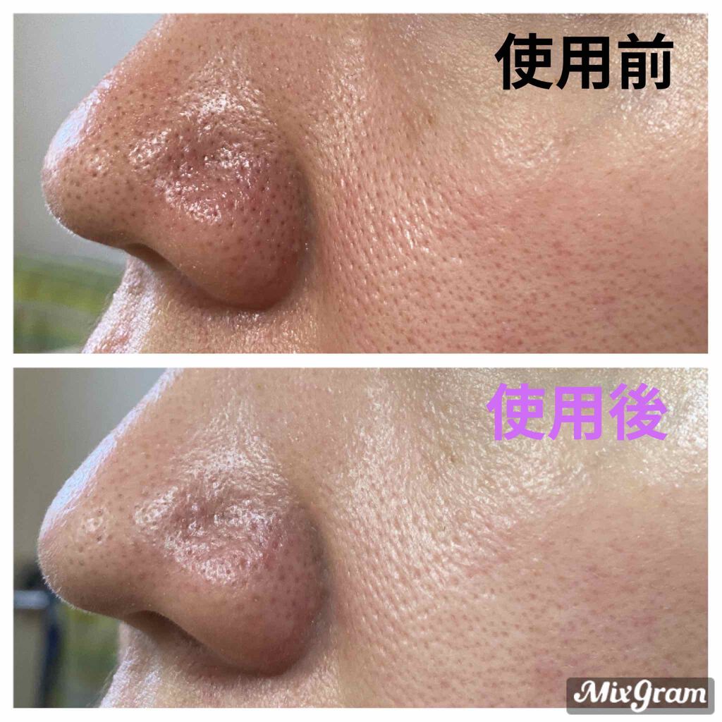 トーンアップＵＶミルク/スキンアクア/日焼け止めミルクを使ったクチコミ（3枚目）