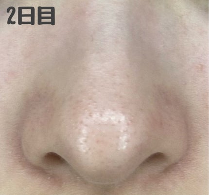 デュオ ザ クレンジングバーム ブラックリペア /DUO/クレンジングバームを使ったクチコミ(2枚目)