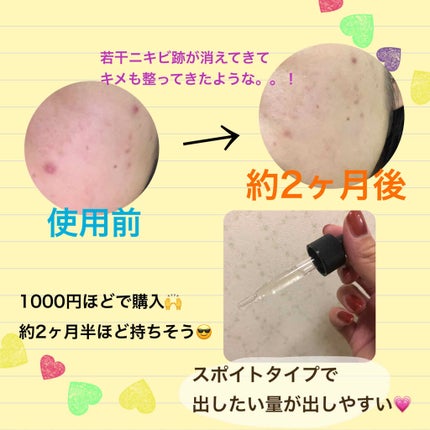 スーパーリンクルセラムVA/KISO/美容液を使ったクチコミ(2枚目)