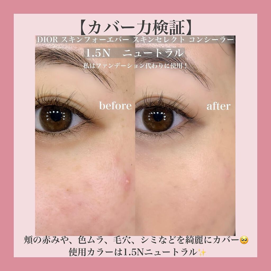 【旧】ディオールスキン フォーエヴァー スキン コレクト コンシーラー/Dior/リキッドコンシーラーを使ったクチコミ(3枚目)