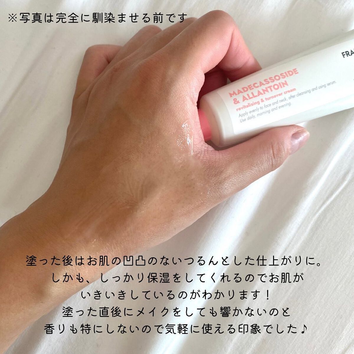マデカソサイド&アラントインクリーム/Frankly/フェイスクリームを使ったクチコミ(4枚目)