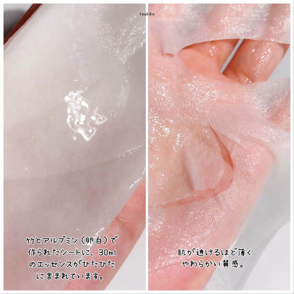 弱酸性pHシートマスク ドクダミフィット/Abib /シートマスク・パックを使ったクチコミ(7枚目)