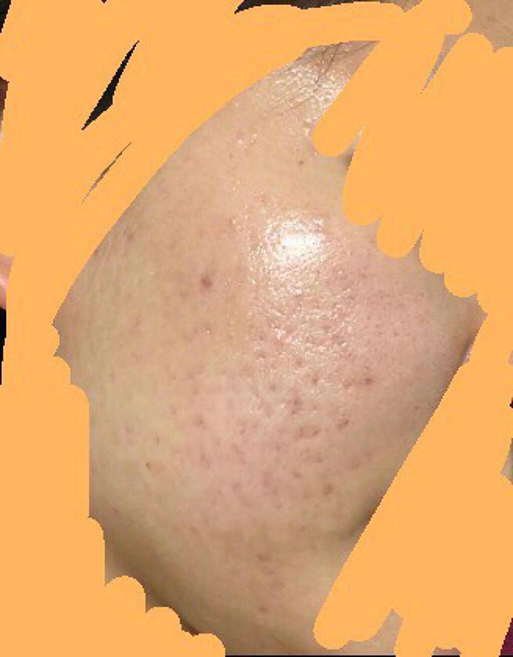 ハトムギ化粧水(ナチュリエ スキンコンディショナー R )/ナチュリエ/化粧水を使ったクチコミ(2枚目)