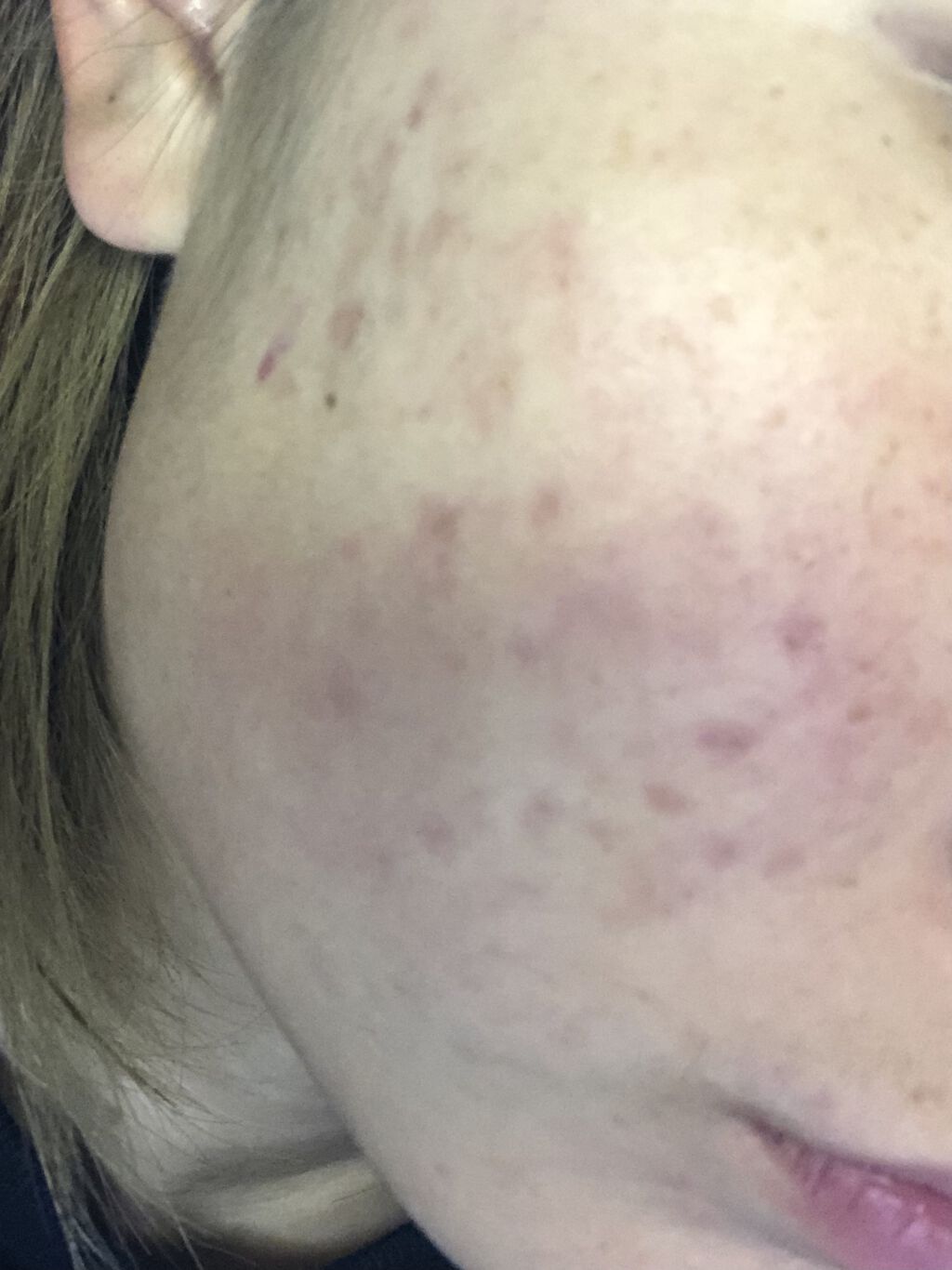 敏感肌用薬用美白美容液/無印良品/美容液を使ったクチコミ（3枚目）