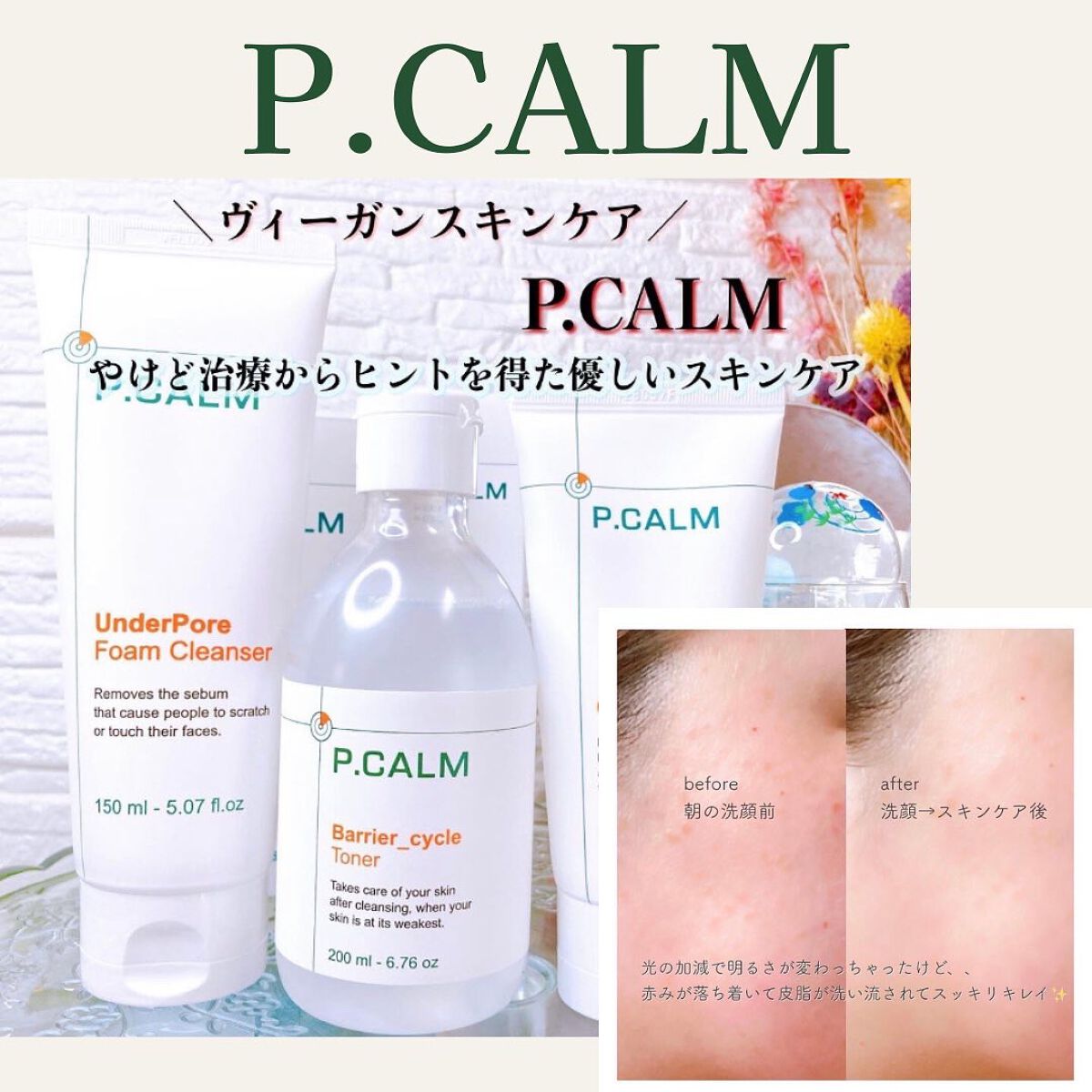 アンダーポアフォームクレンザー/P.CALM/洗顔フォームを使ったクチコミ（1枚目）