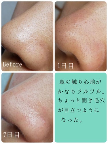 Pore control Blackhead off sheet ビューティシート/Ciracle/シートマスク・パックを使ったクチコミ（2枚目）