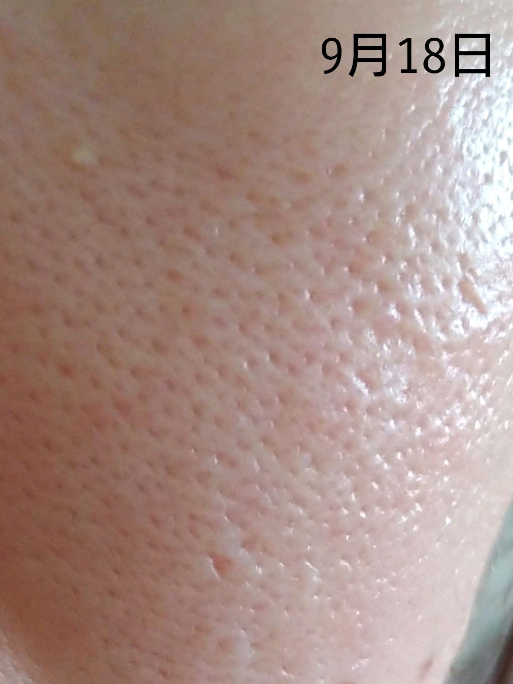 潤浸保湿 乳液/キュレル/乳液を使ったクチコミ（3枚目）