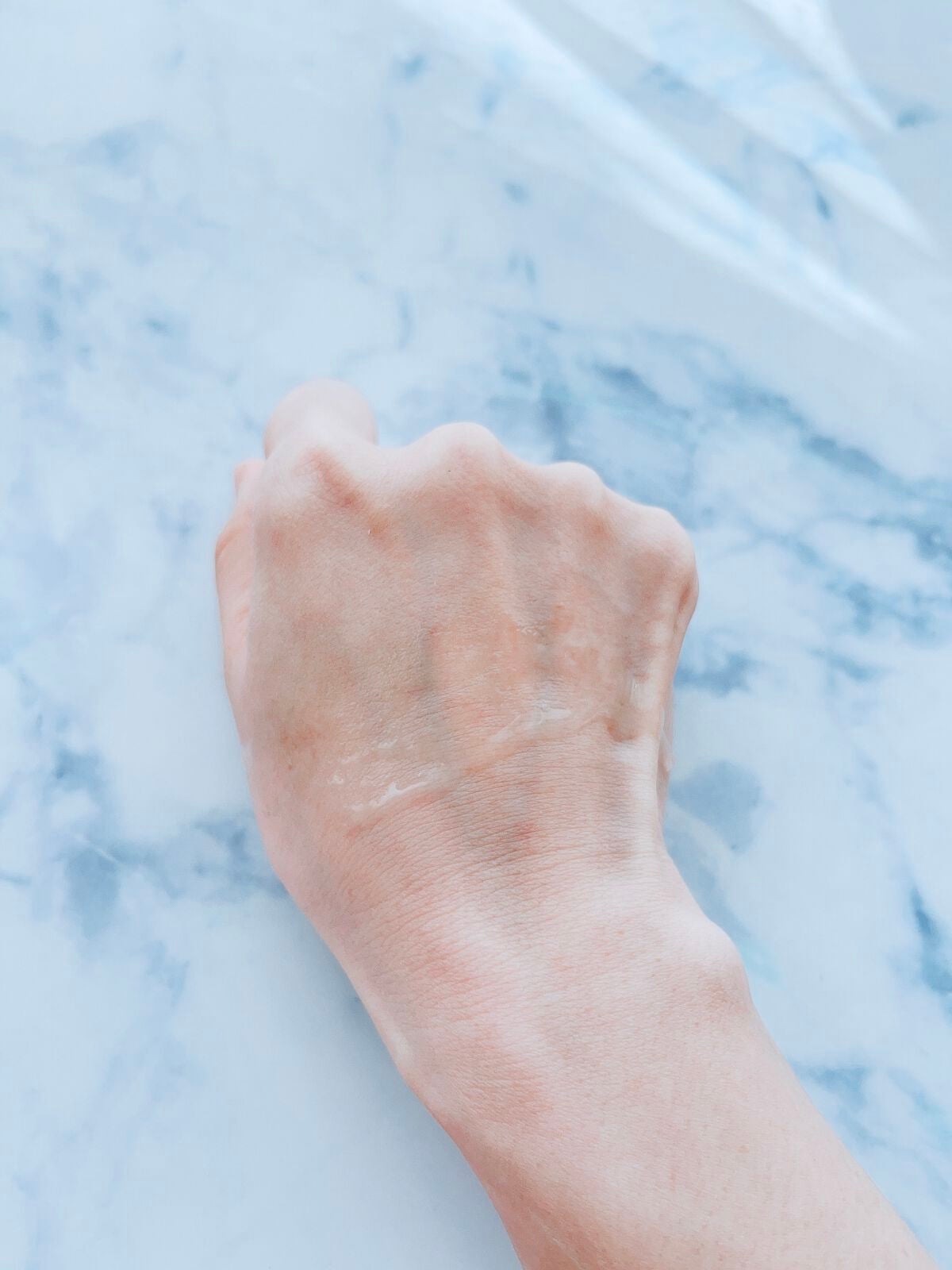 モイスチュアチャージローション/MUNOAGE(ミューノアージュ)/化粧水を使ったクチコミ(4枚目)