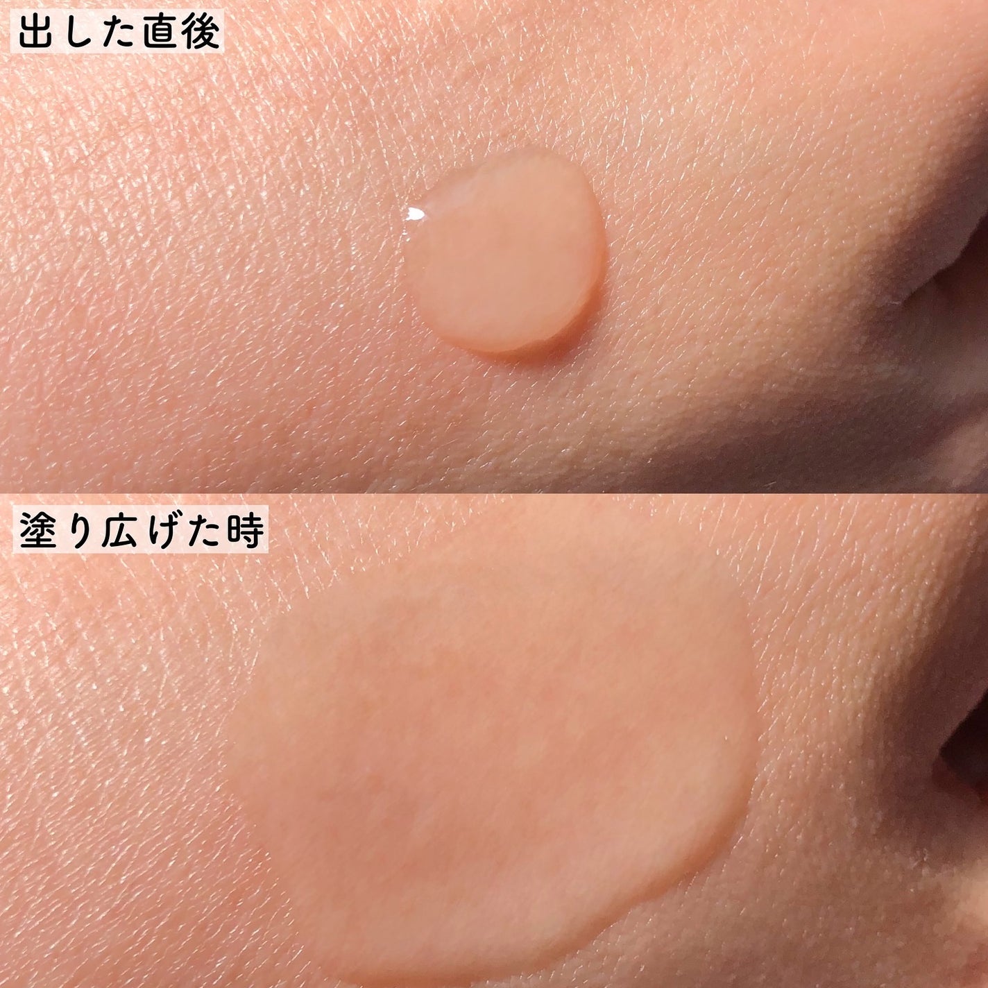 ジェニフィック アルティメ セラム/LANCOME/美容液を使ったクチコミ(5枚目)