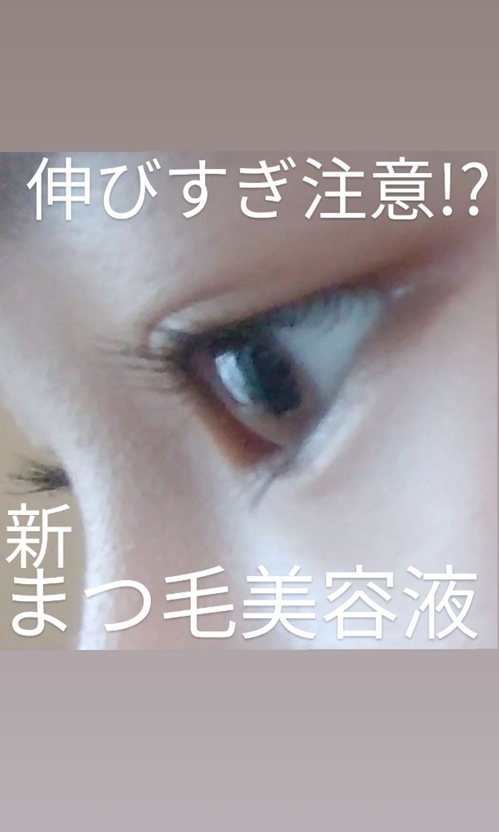 ローヤルゼリー配合 栄養ローション/DAISO/美容液を使ったクチコミ（1枚目）