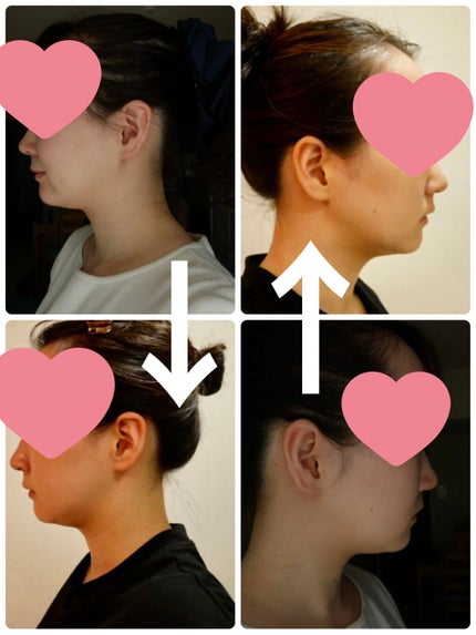 現実頭皮/ラッシュ/頭皮トリートメントを使ったクチコミ(2枚目)