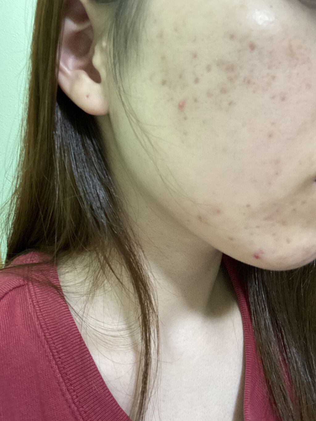 Alpha Arbutin 2% + HA/The Ordinary/フェイスオイルを使ったクチコミ（2枚目）