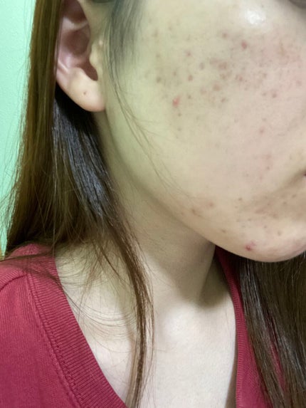 フローラドリップ/ALBION/化粧水を使ったクチコミ(2枚目)