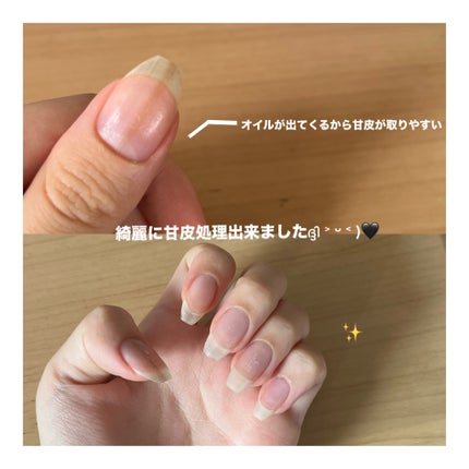 Mimits Moist Cuticle Pen ミミッツ モイストキューティクルペン/ビー・エヌ/ネイル・ネイルケアを使ったクチコミ(3枚目)