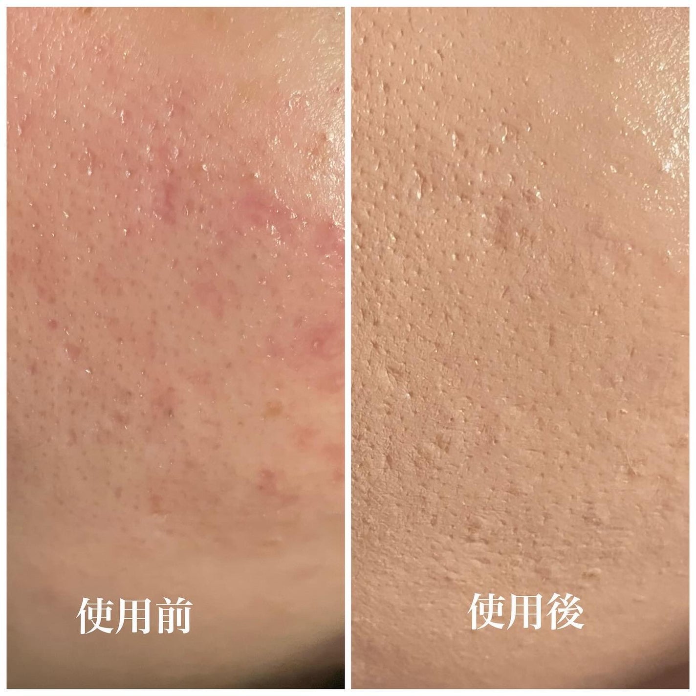 グレーズ ウォータリング クッション/athé/クッションファンデーションを使ったクチコミ(4枚目)