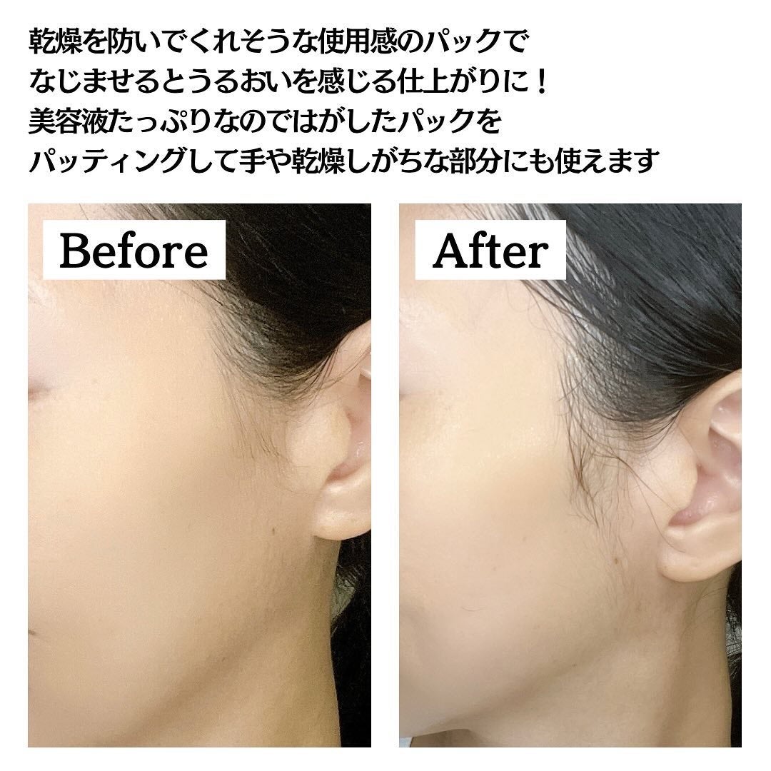 オールナチュラル マスクパックKM/allNATURAL/シートマスク・パックを使ったクチコミ(7枚目)