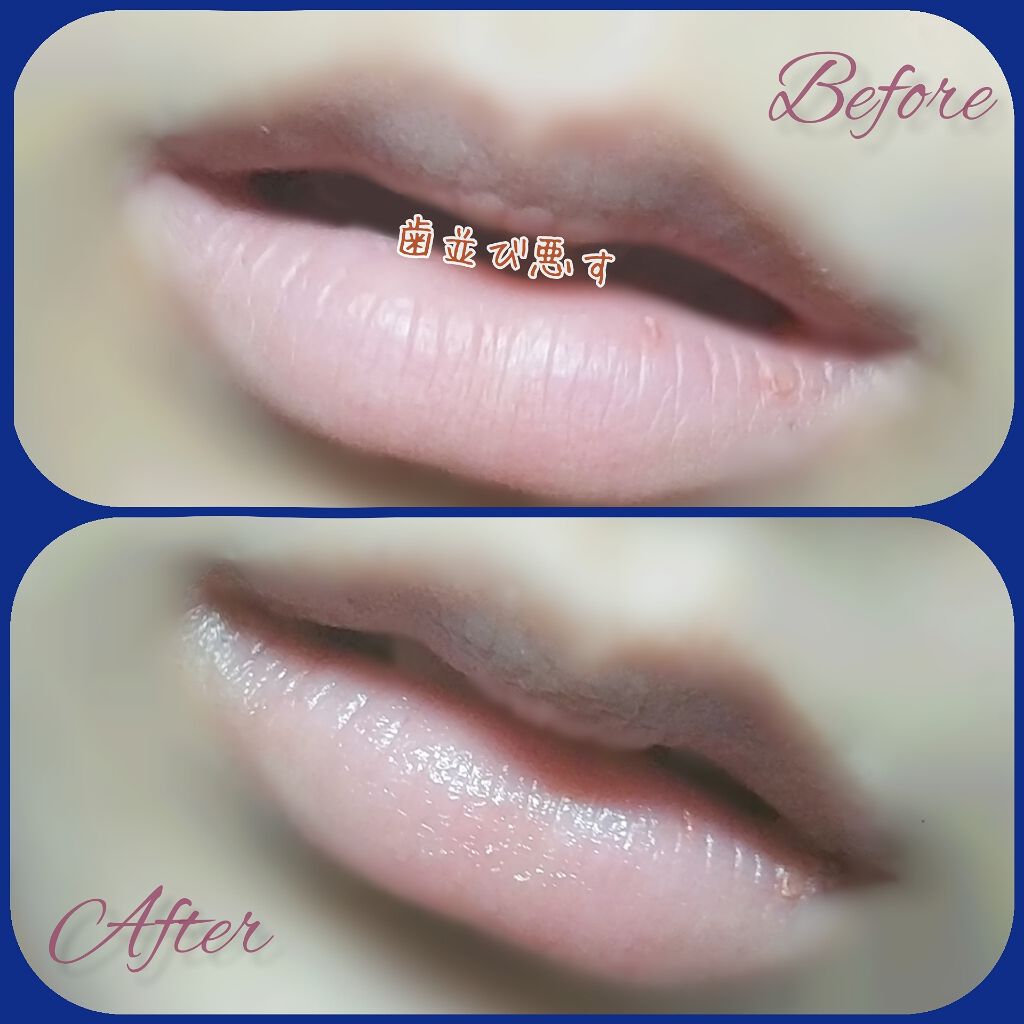 リップ オリジナル/ヴァセリン/リップバームを使ったクチコミ（2枚目）