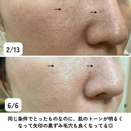 ベビーオイル 無香料/ジョンソンベビー/ボディオイルを使ったクチコミ(2枚目)