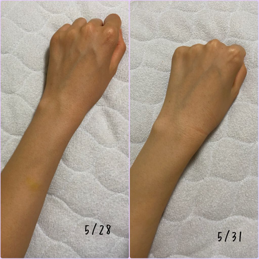 リポスフェリック ビタミンＣ（リポソーム ビタミンC）/Lypo-Spheric/美容サプリメントを使ったクチコミ（3枚目）